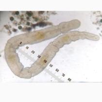 Planarian